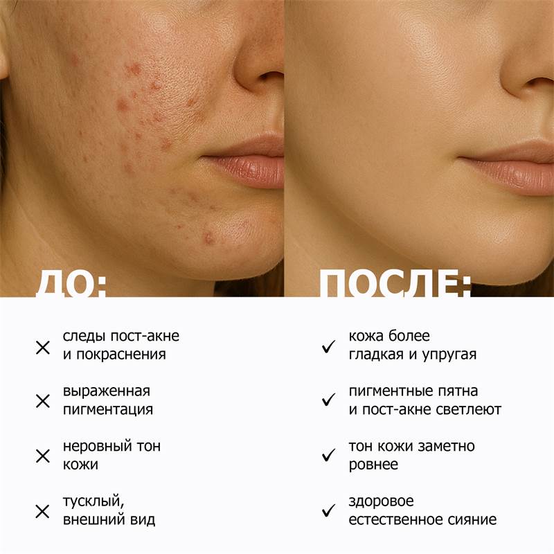 8a661ca3-ba16-11f0-84b8-00d8617040a4-purshatcosmyoshk_8